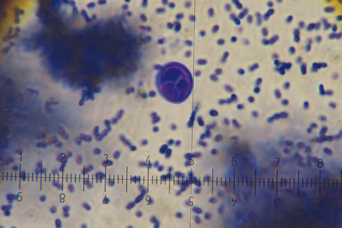 A microscope slide stained with crystal violet shows the presence of Myxobolus cerebralis spores. 