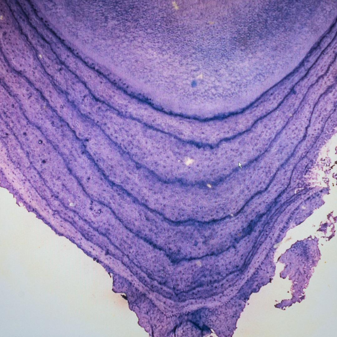 Cross section of a tooth under a microscope with dark blue annual bands
