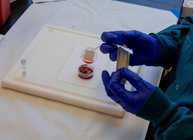 A lymph node sample in a plastic container is prepared for sampling