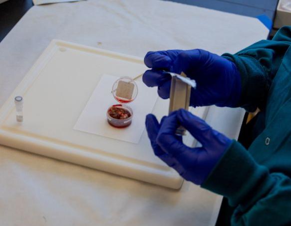 Lymph node testing for Chronic Wasting Disease A lymph node sample in a plastic container is prepared for sampling
