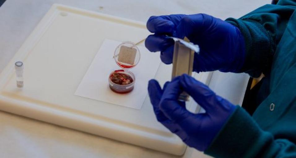 A lymph node sample in a plastic container is prepared for sampling