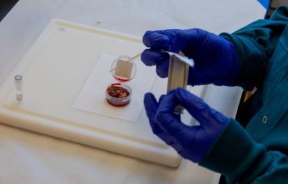 A lymph node sample in a plastic container is prepared for sampling