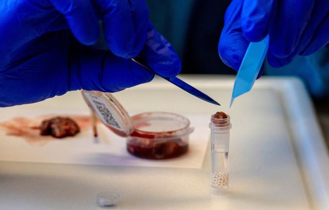 CWD sample